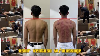 Asmr ventosa wmassage [upl. by Idid]