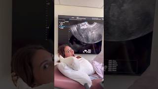 Francesca Farago amp Jesse Sullivan Share Pregnancy Journey and Baby Name Tease shorts shortvideo [upl. by Wolcott]