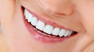 🔴 5 Coisas Para Você Usar Prótese Dentária Removível [upl. by Nhguav566]