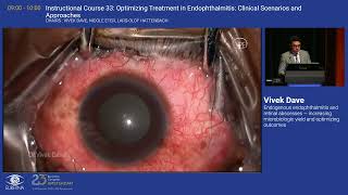 5 Endogenous endophthalmitis and retinal abscesses — increasing microbiologic yield and [upl. by Reyna]