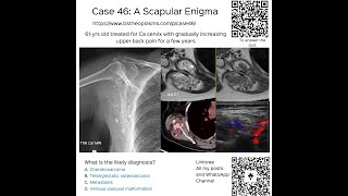 Case 46 A Scapular Enigma [upl. by Althee122]