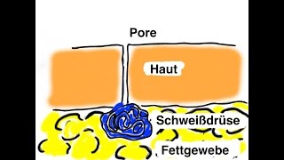 Zu viel Achselschweiß  Absaugung oder Botulinum [upl. by Stacy]