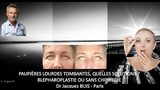 PAUPIERES LOURDES TOMBANTES  QUELLES SOLUTIONS  AVEC BLEPHAROPLASTIE OU SANS CHIRURGIE Dr BUIS J [upl. by Severen]