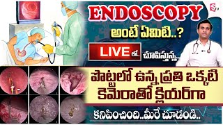 కడుపులో సమస్యలు  Know About Colonoscopy And Endoscopy  Gleneagles Hospital  DrGSSameer Kumar [upl. by Tnomed277]