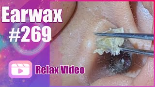 Remove earwax with tweezers  how to remove wax from ear [upl. by Wheelwright]