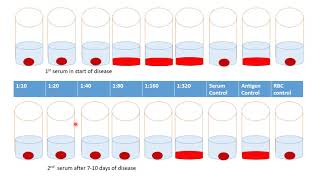 Reaction of inhibition of hemagglutination for detection the antibidies in pair sera [upl. by Auj315]