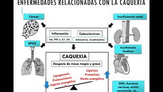 sarcopenia y caquexia [upl. by Nnadroj]