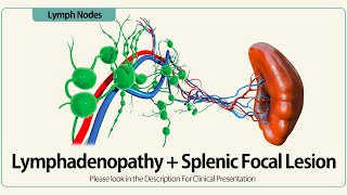 Lymphadenopathy and Splenic Focal Lesion [upl. by Airenahs267]