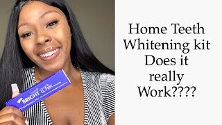 Bright White Teeth Whitening review [upl. by Linus]