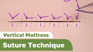 Suture Techniques and Training Series Interrupted Vertical Mattress Suture Technique [upl. by Aleunam]