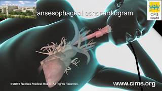 Echocardiogram [upl. by Hofmann]