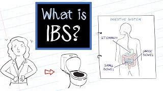 What is IBS Irritable Bowel Syndrome [upl. by Argyres]