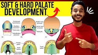 development of palate embryology  soft palate development embryology [upl. by Ahsimet278]