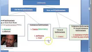 Parasitology 061 b Leishmania donovani leishmaniasis Kala azar Lab Diagnosis LD bodies Montenegro [upl. by Louisa]