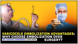 Varicocele  Nonsurgical treatment of Varicocele  Varicocele embolization  Dr Gaurav Gangwani [upl. by Granese]