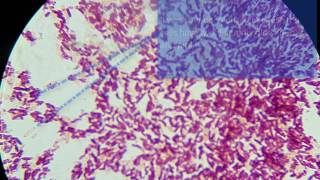 HeLa cells dividing over 27hrs cells round up grow hair then divide [upl. by Kareem]