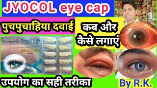 Jyocol eye caps ke fayde  chloramphenicol eye ointment uses in hindi  पुचपुचाहिया दवाई  jyocol [upl. by Archangel79]