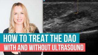 DAO Depressor Anguli Oris Treatment Tips with and without Ultrasound [upl. by Noraf130]