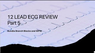 12 Lead ECG Review Part 5 [upl. by Arbuckle]