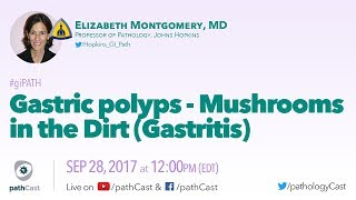 Gastric polyps  Mushrooms in the dirt GASTRITIS [upl. by Adnimra]