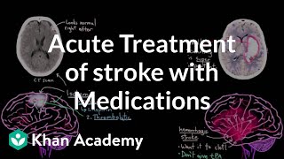 Acute treatment of stroke with medications  NCLEXRN  Khan Academy [upl. by Sehcaep]