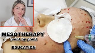 Mesotherapy for face full demo and point by point injection technique [upl. by Alyhs]