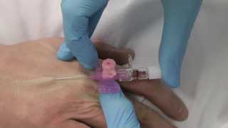 Cannulation How to insert a cannula One Minute Edition Medicine in a Nutshell IV Access [upl. by Berty355]