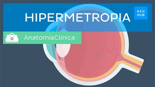 Hipermetropia Definição causas sintomas diagnóstico e tratamento  Kenhub [upl. by Llorre124]