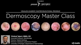 Dermoscopy Master Class [upl. by Dwayne66]