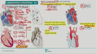 21 PEDIATRIA  CARDIOPATIAS CONGENITAS  QX MEDIC 2021 [upl. by Crespo]