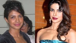 Bollywood Actresses who underwent SKIN LIGHTENING Surgery [upl. by Kcirrad534]