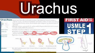 Urachus Patent Urachus Urachal cyst Vesicourachal diverticulum in HindiUrdu by first aid [upl. by Adnuhsar925]