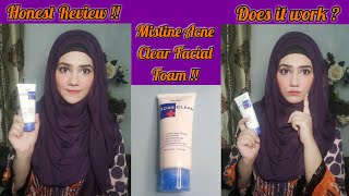 Mistine Acne Clear Facial Foam Review  My Experience amp Honest Review [upl. by Dicks4]