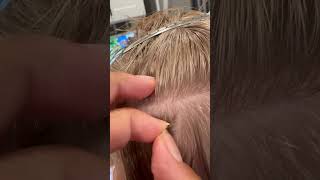 Lice removal l small business explore hair lice hairvideo liceremoval shorts [upl. by Aikemahs602]