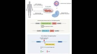 New gene therapies for hemoglobinopathies [upl. by Nalloh]