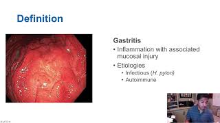 Gastritis vs Gastropathy [upl. by Torto]