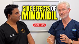 Side Effects of Minoxidil [upl. by Nicodemus]