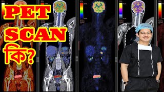 PET Scan কি health doctor rectalbleeding science constipation rectalcancer [upl. by Jegger]