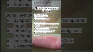 Chronic spontaneous urticaria [upl. by Neelloj]