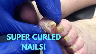 SUPER CURLED NAIL CARE [upl. by Witha]