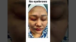 VJ Thapa Raghu Permanent Eyebrows  Dr Aesthetix Cosmetic Clinic ChennaiAesthetixwithDrHemamalini [upl. by Anaehr]