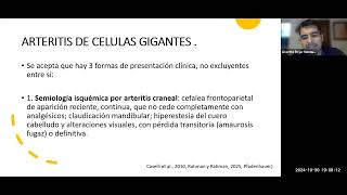 Arteritis de Células Gigantes [upl. by Huai]