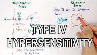 Type IV Hypersensitivity [upl. by Krell279]