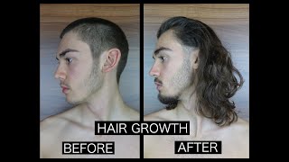 HAIR GROWTH TIME LAPSE  SIDE [upl. by Haim]