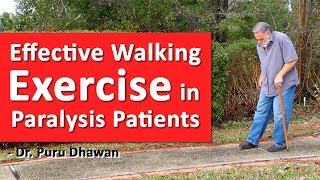 Effective Walking Exercises in Paralysis Patients [upl. by Kristine440]