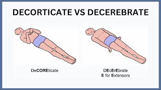 Decorticate vs Decerebrate Explained [upl. by March]