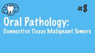 Oral Pathology  Connective Tissue Malignant Tumors  INBDE ADAT [upl. by Chelsie]