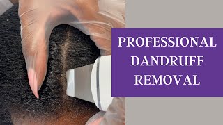 Watch me do Scalp Rejuvenation Therapy for DandruffDermatitisPsoriasis 😮 [upl. by Aicelaf]