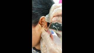 earloberepairhow to repair ear lobe 👂 [upl. by Skeie538]