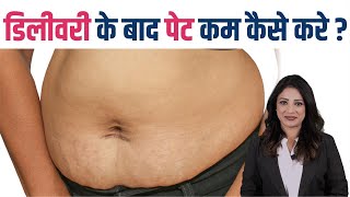 डिलीवरी के बाद पेट कम कैसे करे  How to Reduce Belly Fat after Pregnancy [upl. by Rojam]